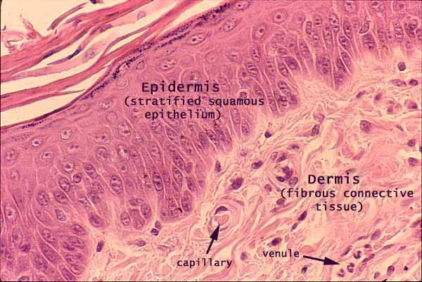 Epidermis and dermis